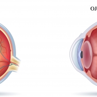 ¿Qué es la degeneración macular relacionada con la edad?